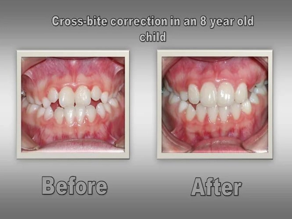 Before and After